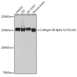 Collagen III alpha 1/COL3A1 Rabbit mAb