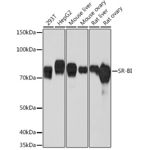 SR-BI Rabbit mAb