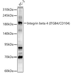 Integrin beta 4 (ITGB4/CD104) Rabbit pAb