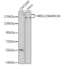 [KO Validated] BRG1/SMARCA4 Rabbit pAb