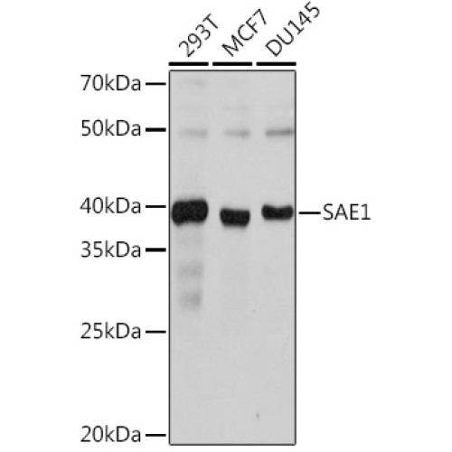 SAE1 Rabbit mAb