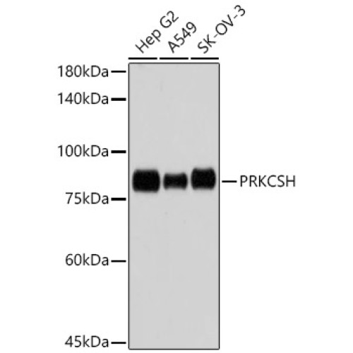 PRKCSH Rabbit mAb