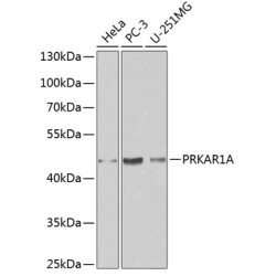 [KO Validated] PRKAR1A Rabbit pAb