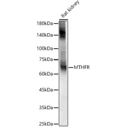 EAAT2/SLC1A2 Rabbit pAb