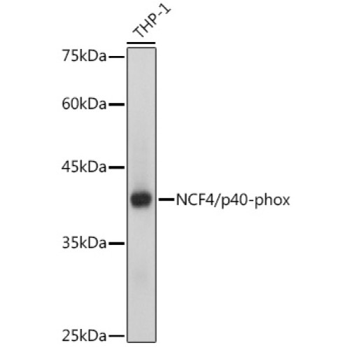 NCF4/p40-phox Rabbit mAb