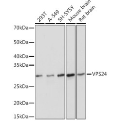 VPS24 Rabbit mAb