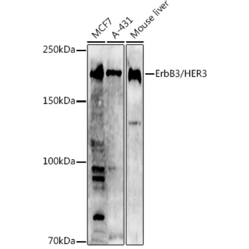 [KO Validated] ErbB3/HER3 Rabbit pAb