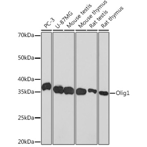 Olig1 Rabbit mAb