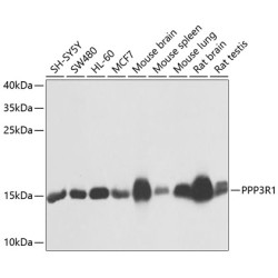 PPP3R1 Rabbit pAb