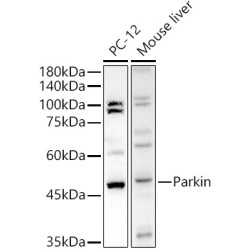 Human Parkin Rabbit pAb