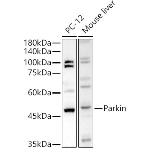 Human Parkin Rabbit pAb