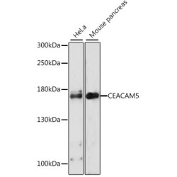 CEACAM5 Rabbit pAb