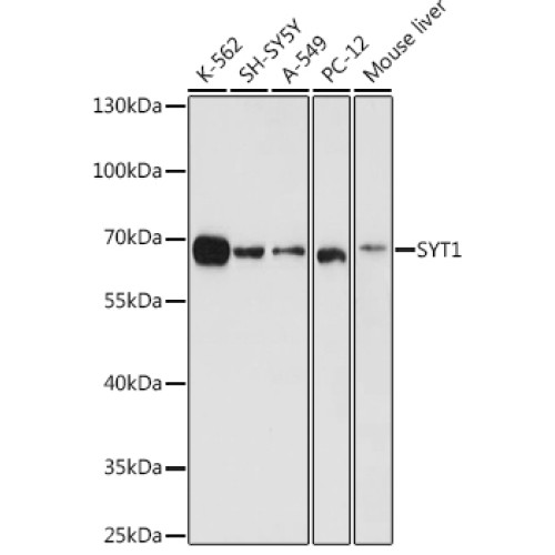 SYT1 Rabbit pAb