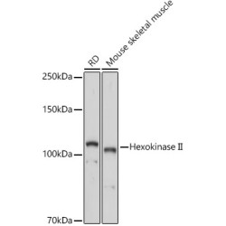 Hexokinase II Rabbit pAb
