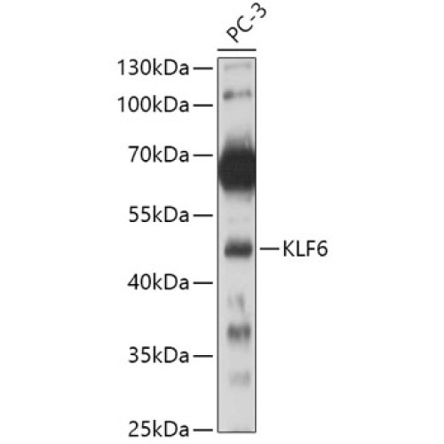 KLF6 Rabbit pAb
