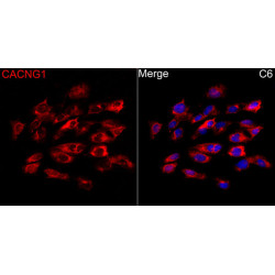CACNG1 Rabbit pAb