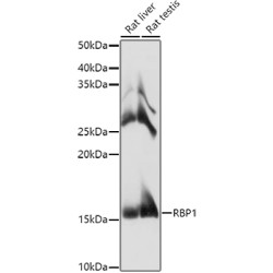 RBP1 Rabbit pAb