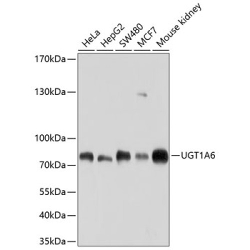 UGT1A6 Rabbit pAb