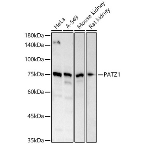 PATZ1 Rabbit pAb