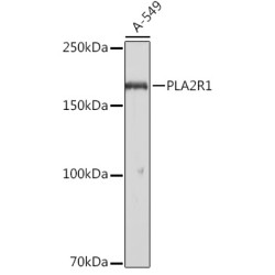 PLA2R1 Rabbit pAb