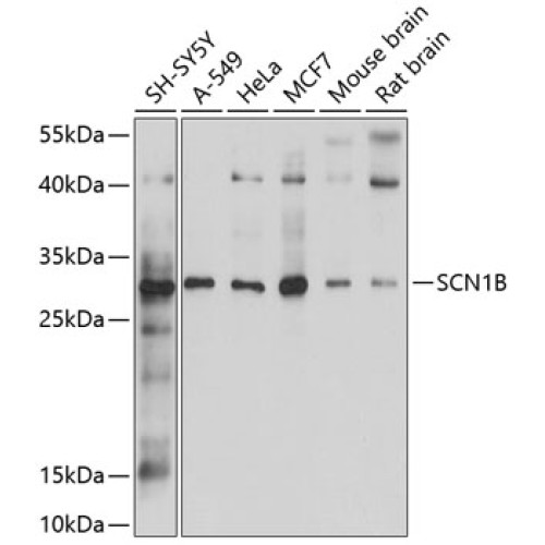 SCN1B Rabbit pAb
