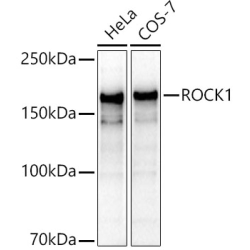 [KO Validated] ROCK1 Rabbit pAb