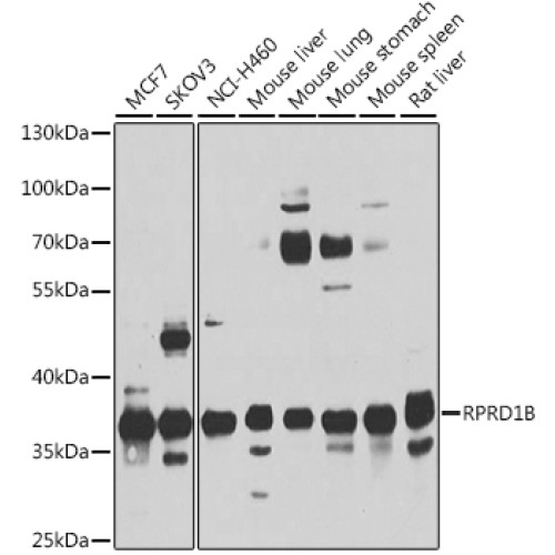 RPRD1B Rabbit pAb