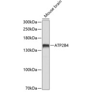 ATP2B4 Rabbit pAb