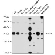 ATP4B Rabbit pAb