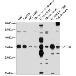 ATP4B Rabbit pAb