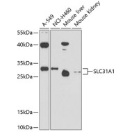 SLC31A1 Rabbit pAb