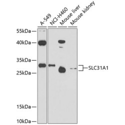 SLC31A1 Rabbit pAb