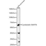 Cytokeratin 9 (KRT9) Rabbit pAb