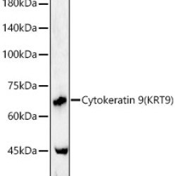 Cytokeratin 9 (KRT9) Rabbit pAb