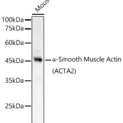 α-Smooth Muscle Actin (ACTA2) Rabbit pAb