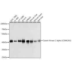 Casein Kinase 2 alpha (CSNK2A1) Rabbit pAb