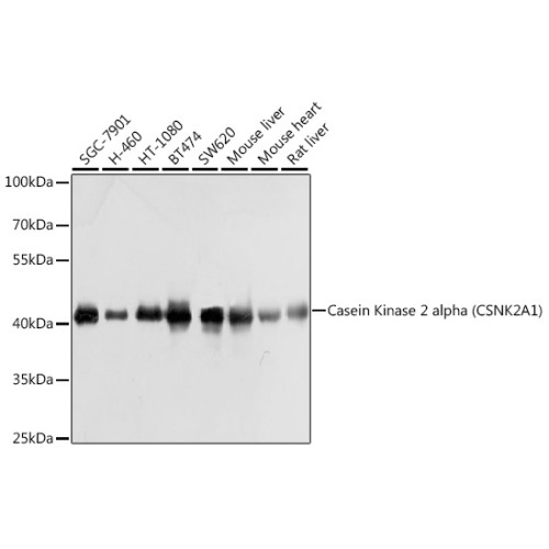 Casein Kinase 2 alpha (CSNK2A1) Rabbit pAb