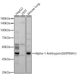 Alpha-1 Antitrypsin (SERPINA1) Rabbit pAb