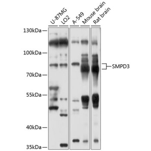 SMPD3 Rabbit pAb