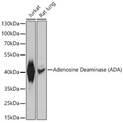 Adenosine Deaminase (ADA) Rabbit pAb