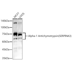 Alpha-1 Antichymotrypsin (SERPINA3) Rabbit pAb