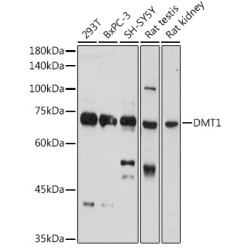 DMT1/SLC11A2 Rabbit pAb