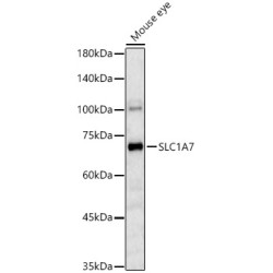SLC1A7 Rabbit pAb