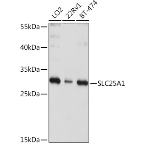 SLC25A1 Rabbit pAb
