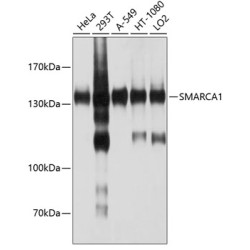 SMARCA1 Rabbit pAb