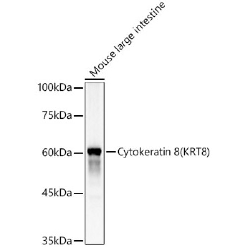Cytokeratin 8 (KRT8) Rabbit pAb