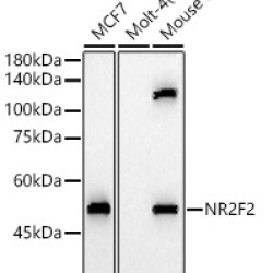 NR2F2 Rabbit pAb