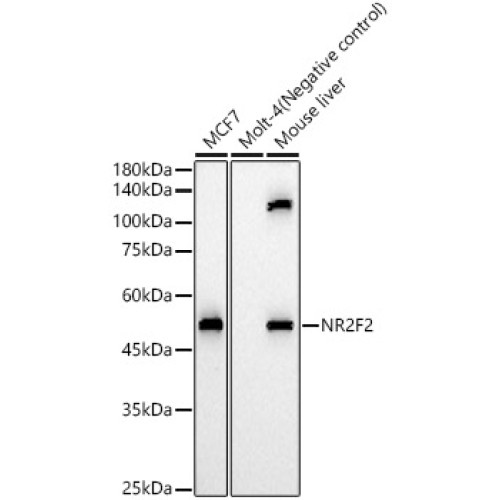 NR2F2 Rabbit pAb