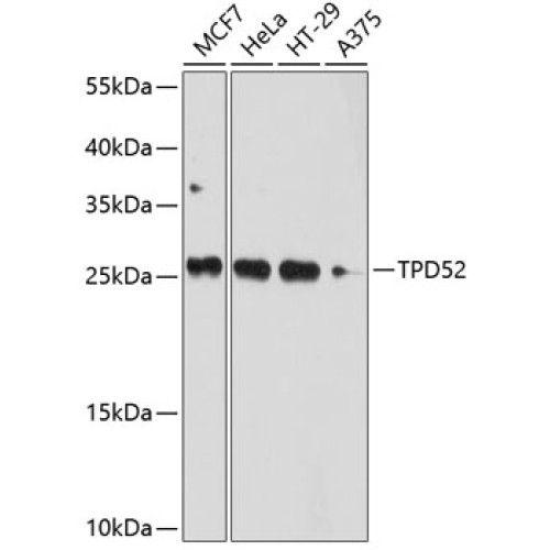 TPD52 Rabbit pAb