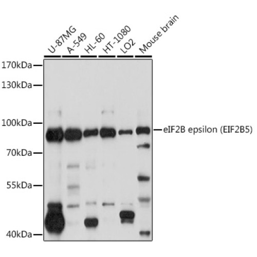 eIF2B epsilon (EIF2B5) Rabbit pAb